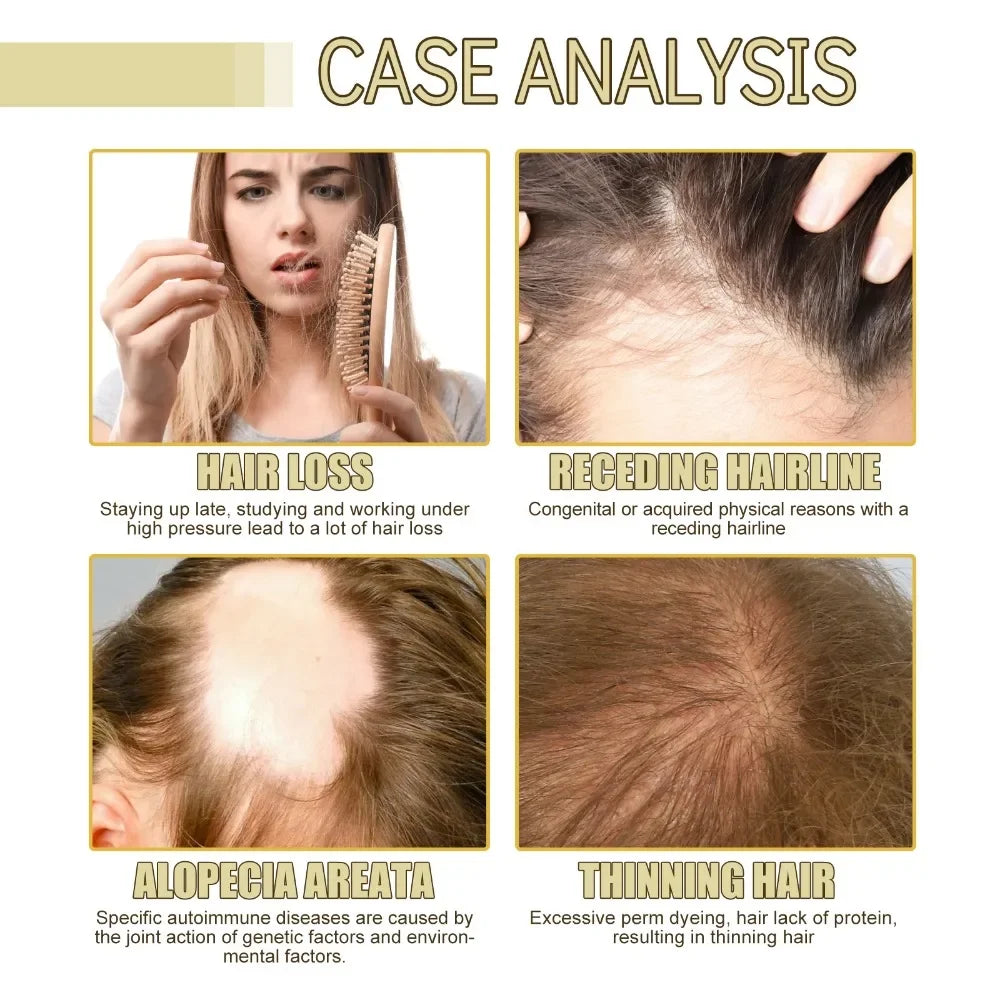 Rosmarin dichtes Haar ätherisches Öl Veganic Lavendel repariert Haarschäden, verhindert Haarausfall, glättet die Haare, nährt die Haarpflegeöl 60ml
